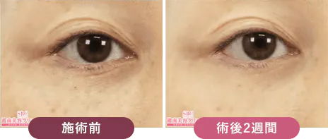 心斎橋でリジュラン注射が安いおすすめのクリニック 湘南美容クリニックのLP画像 症例写真