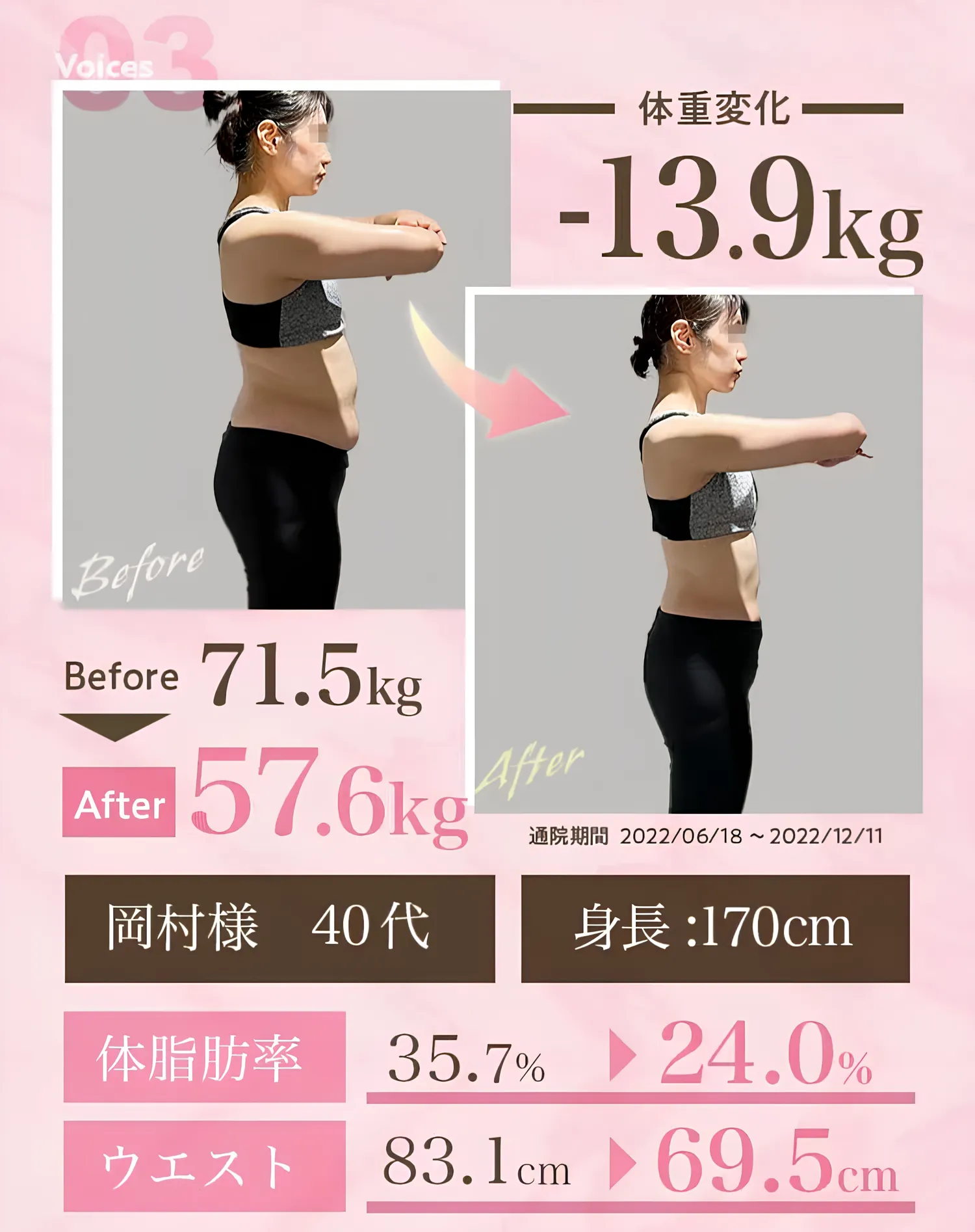 ディオクリニックの医療ダイエットの症例写真