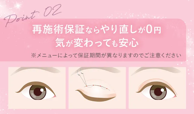 TCBの二重整形はアフターケアも充実！