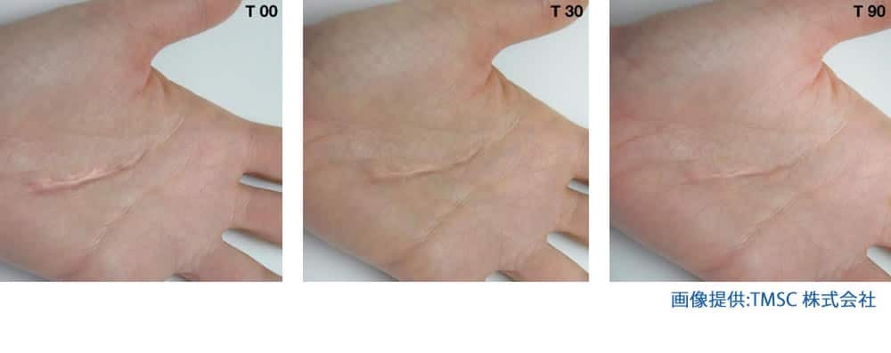 リジェネラの症例写真 (4)