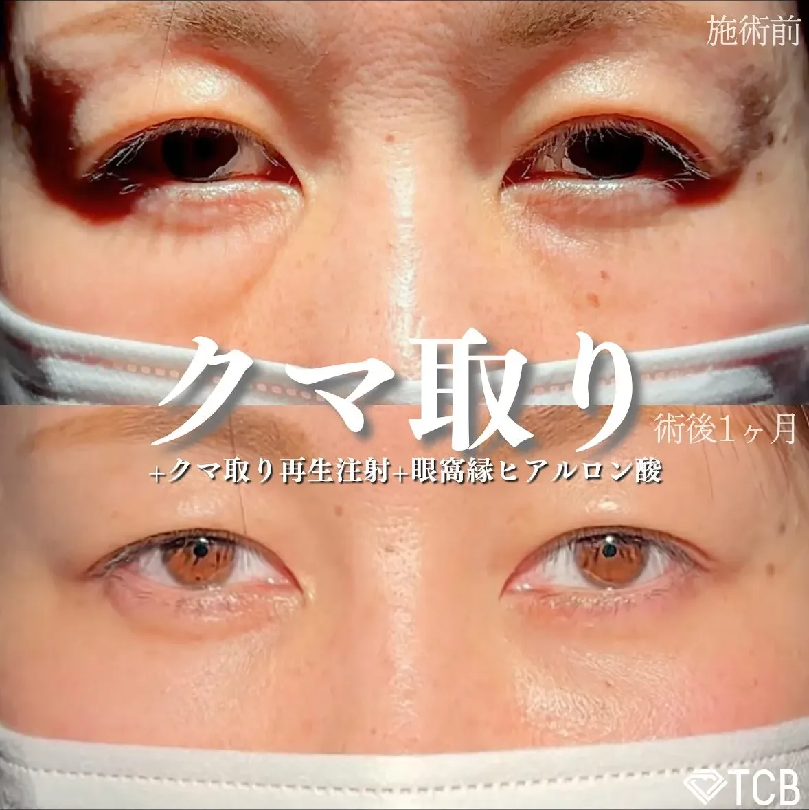 TCB新宿西口院　福本医師の症例