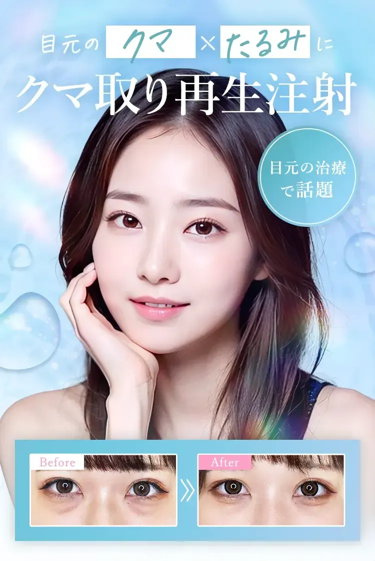 TCBのクマ取り施術