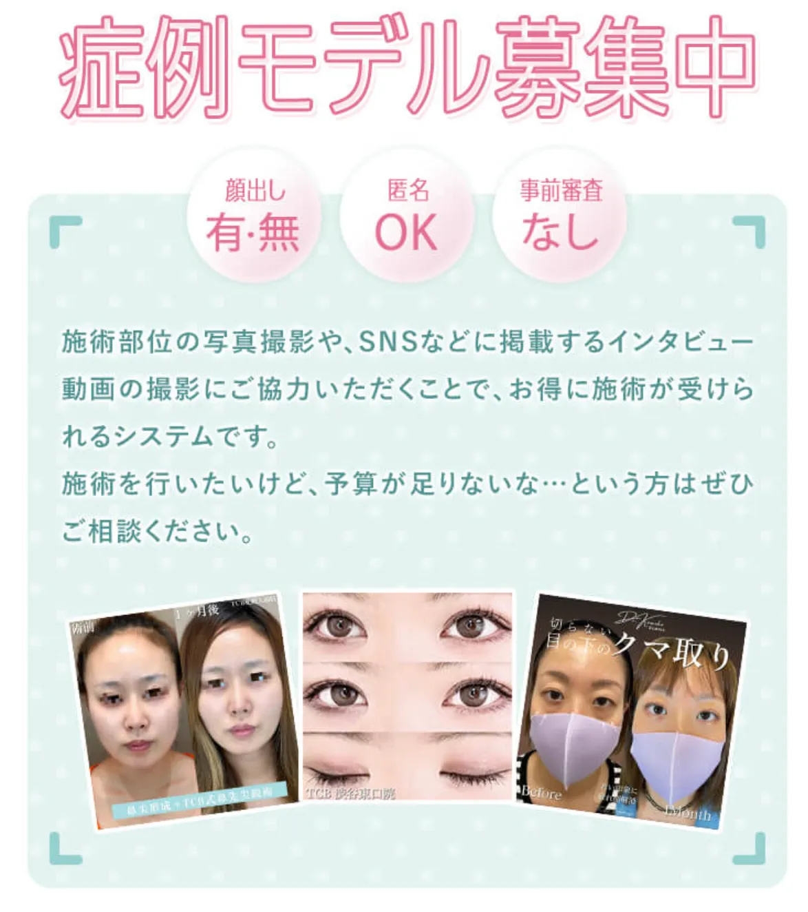 TCBのモニターの条件は？無料になるのは本当なのか専門家が解説｜症例モデル募集画像