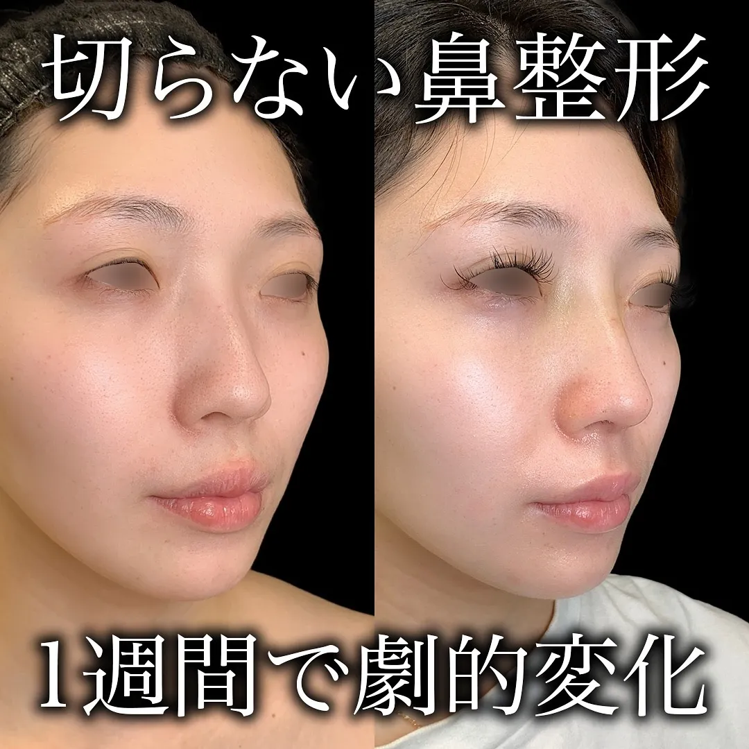 eクリニックの症例写真