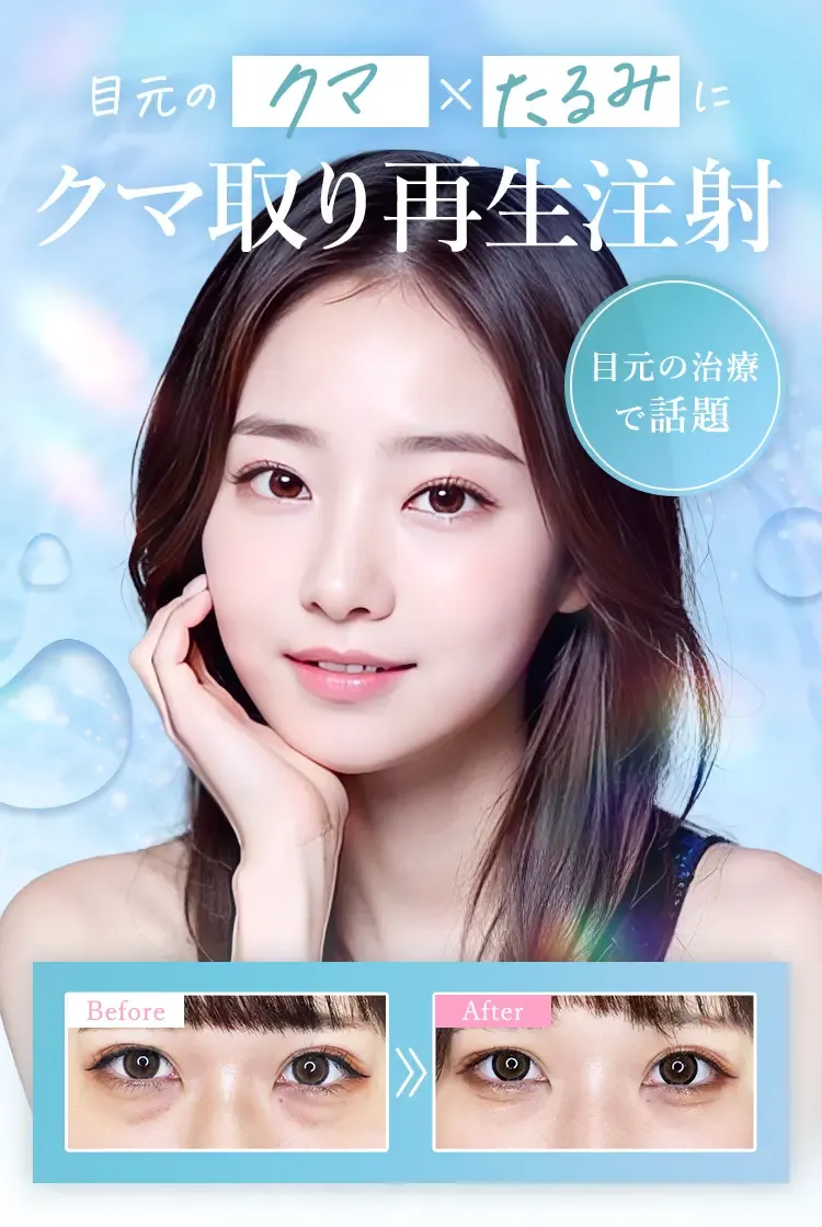 TCBのクマ取り施術