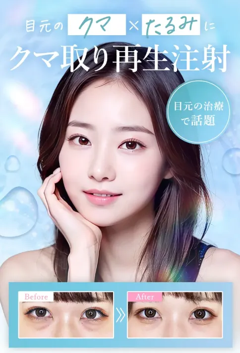 TCBのクマ取り整形