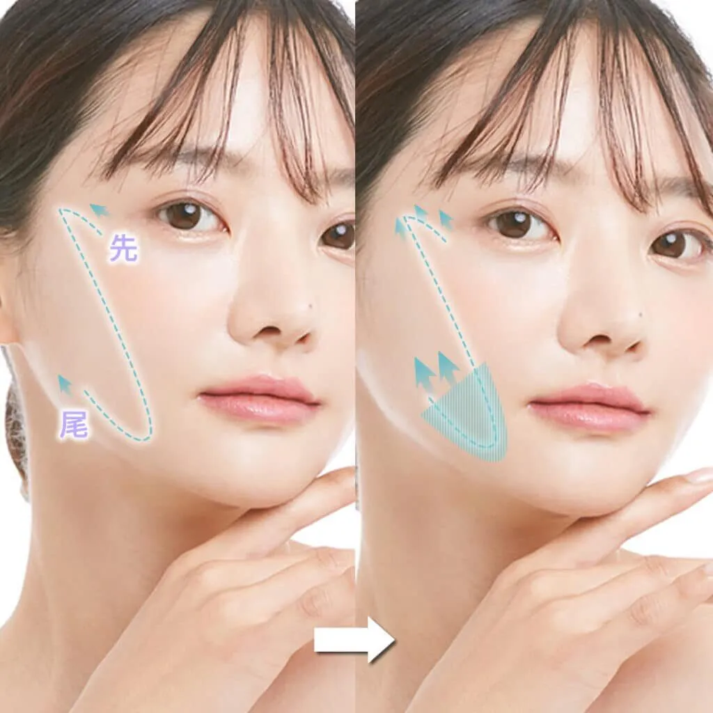 札幌で糸リフトが安いおすすめのクリニック　eクリニックのLP画像　治療概要