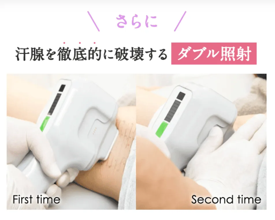 札幌でミラドライが人気の共立美容外科の施術内容