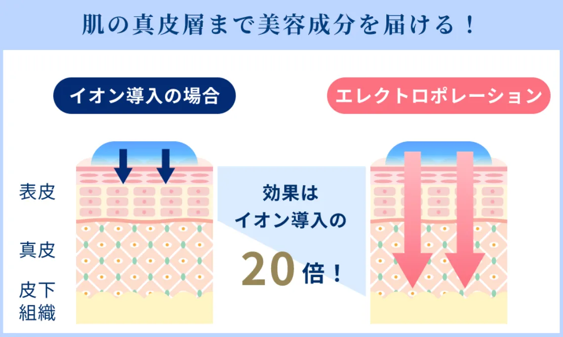 やばい・やめたほうがいいと知恵袋で書き込みのあるストラッシュの脱毛の仕組み