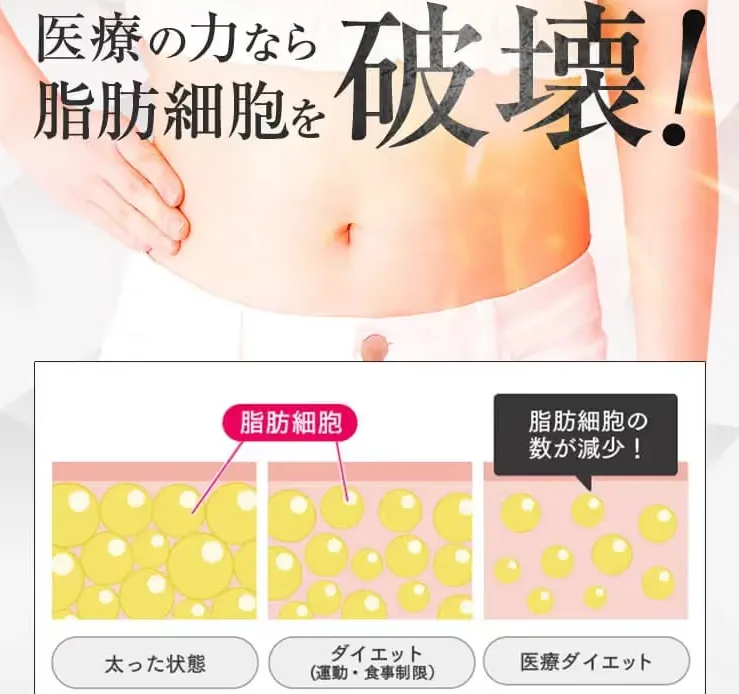 URARAクリニックの脂肪冷却のしくみについて