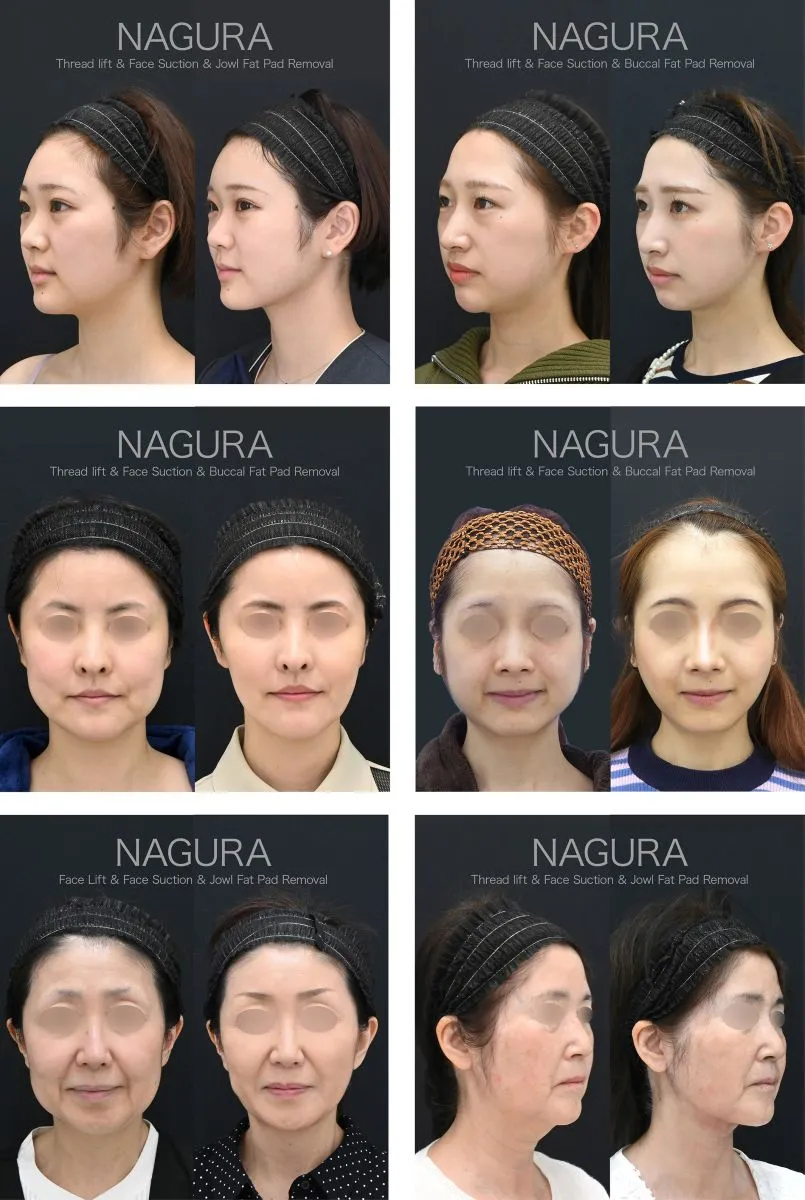 湘南美容外科のドクターランキング上位医師 名倉医師の症例