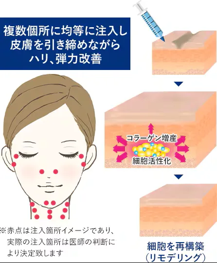 湘南美容クリニックのプロファイロの口コミ評判【料金も調査】プロファイロの説明