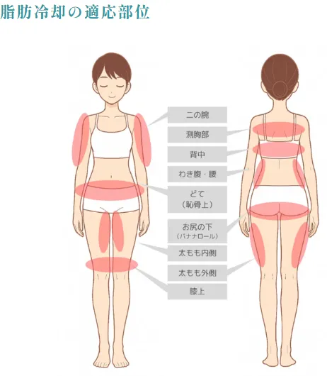千葉で脂肪冷却が安いおすすめのクリニック　施術可能箇所