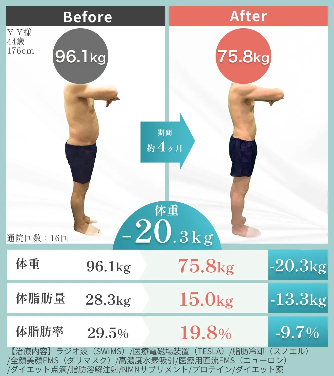 横浜/神奈川で脂肪冷却が安いおすすめクリニック URARAクリニックのメンズの症例写真