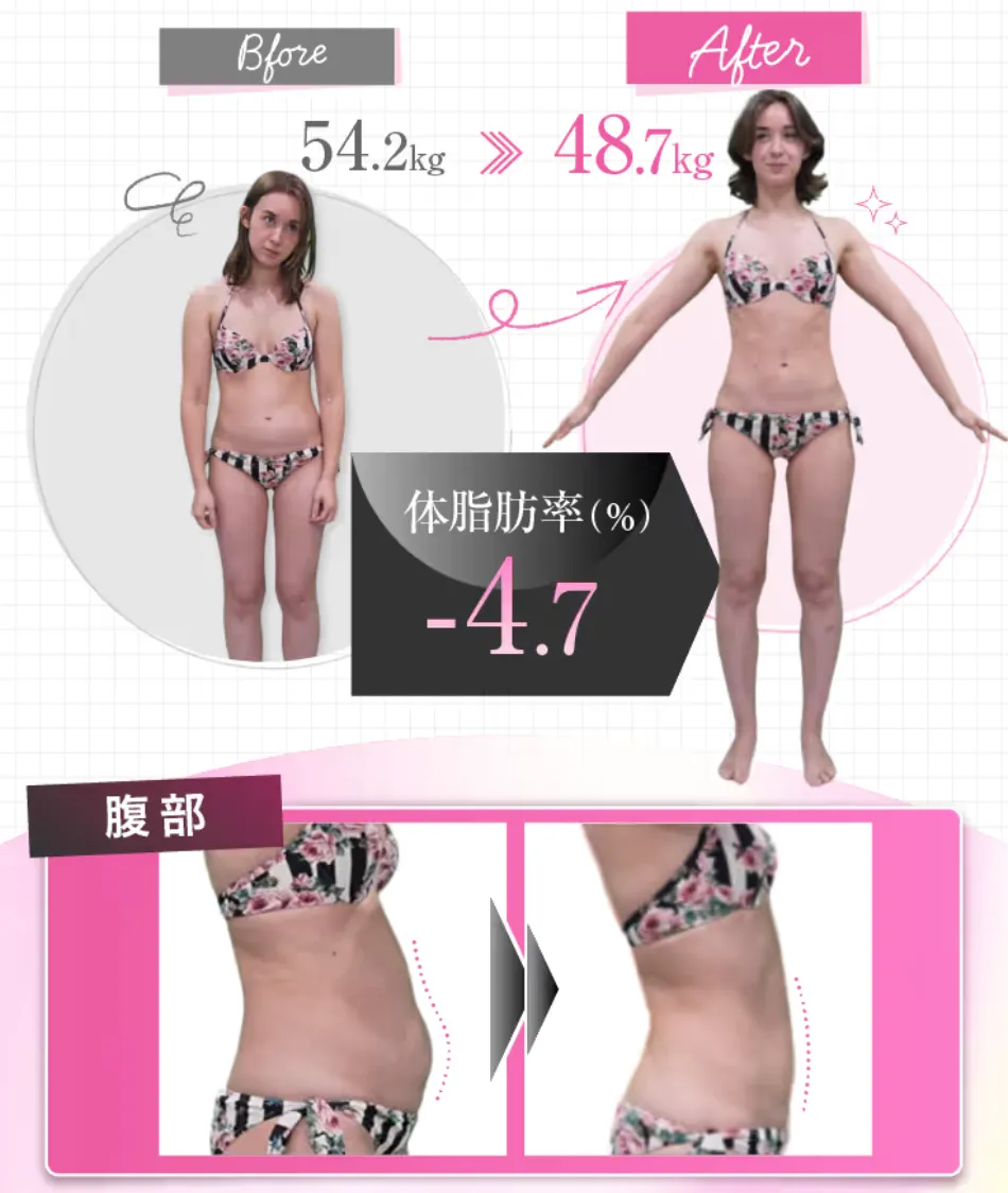 銀座で脂肪冷却が安いおすすめのクリニック　uraraクリニックの効果の高さ