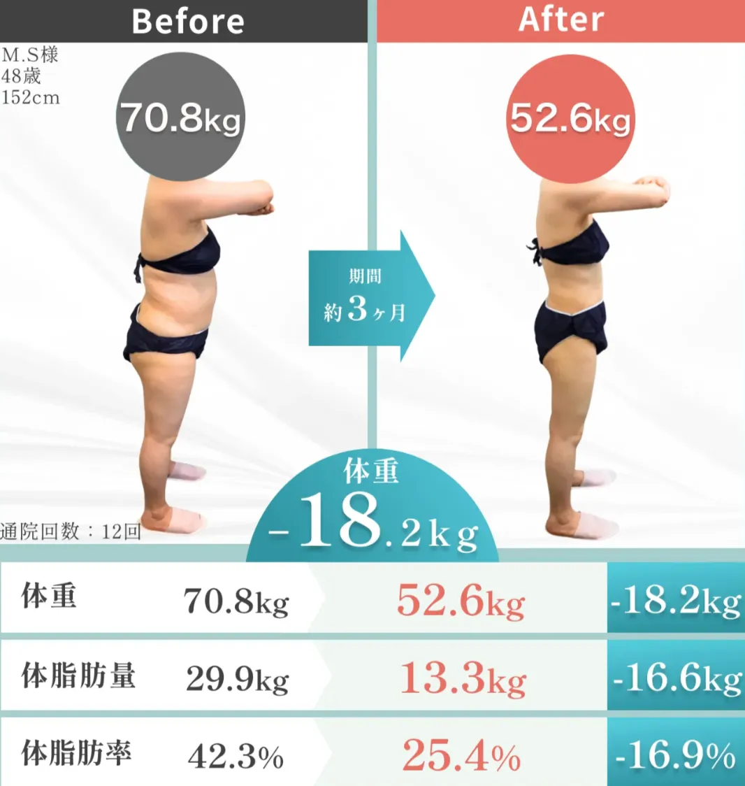 銀座で脂肪冷却が安いおすすめのクリニック　uraraクリニックの施術実績