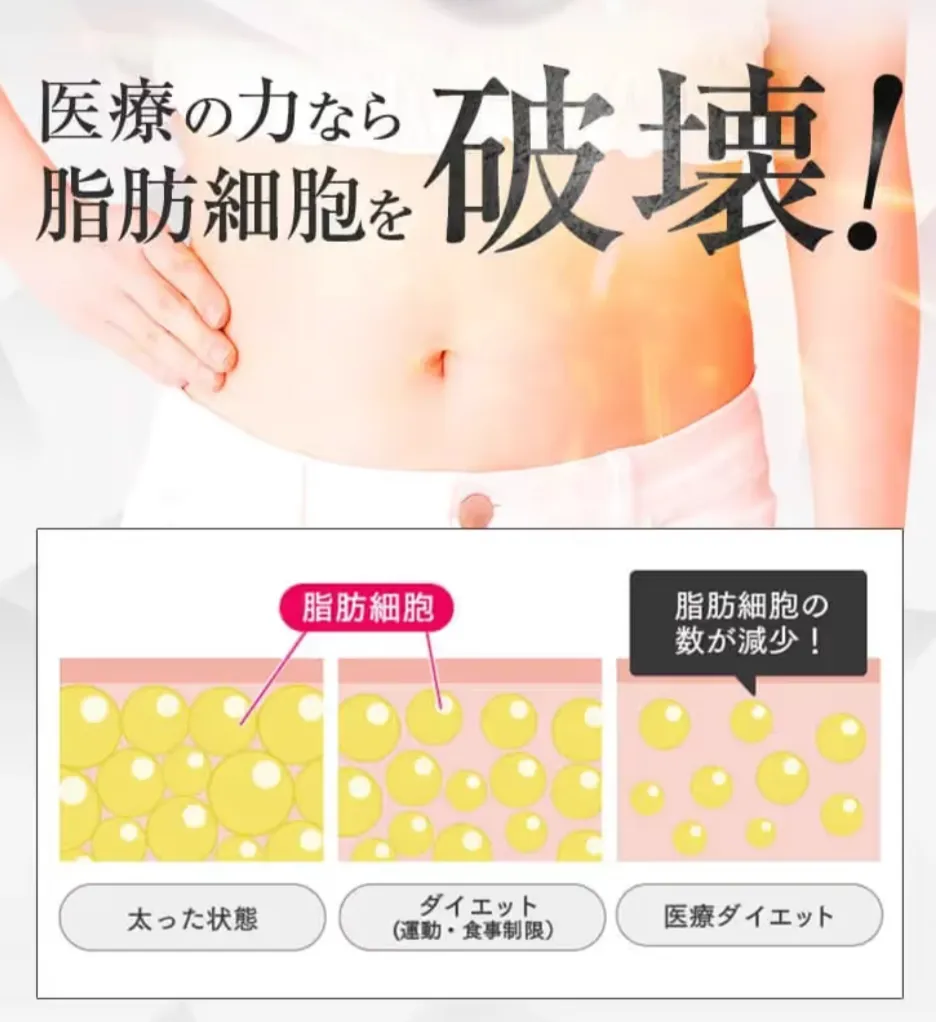 銀座で脂肪冷却が安いおすすめのクリニック　uraraクリニックの施術について