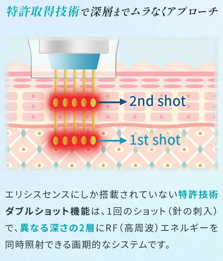 大阪でエリシスセンスが安いおすすめのクリニック｜WINクリニックのエリシスセンスの仕組み