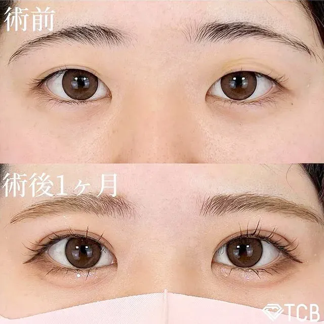  TCBの80,000円クーポン