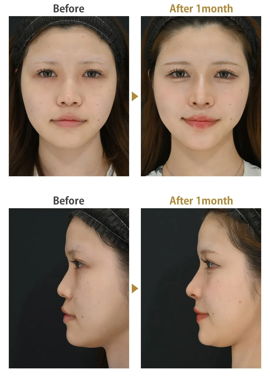 湘南美容外科のドクターランキング上位医師 居川医師の症例