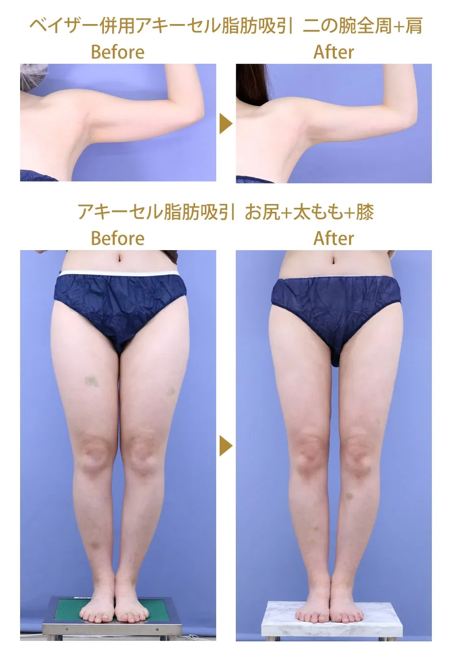 湘南美容外科のドクターランキング上位医師 須田医師の症例