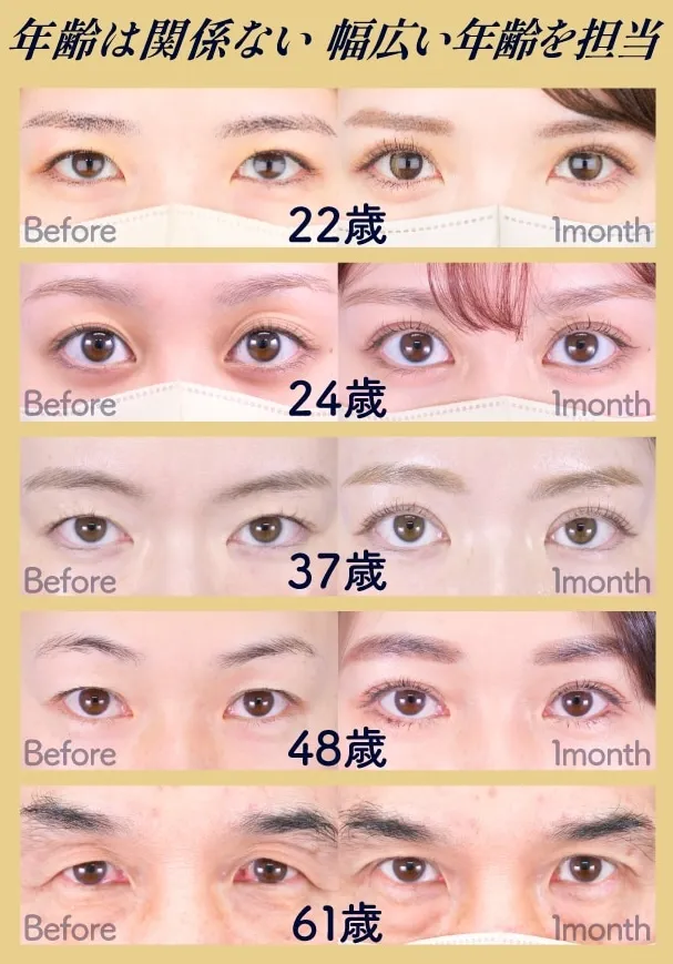 湘南美容外科のドクターランキング上位医師 金医師の症例