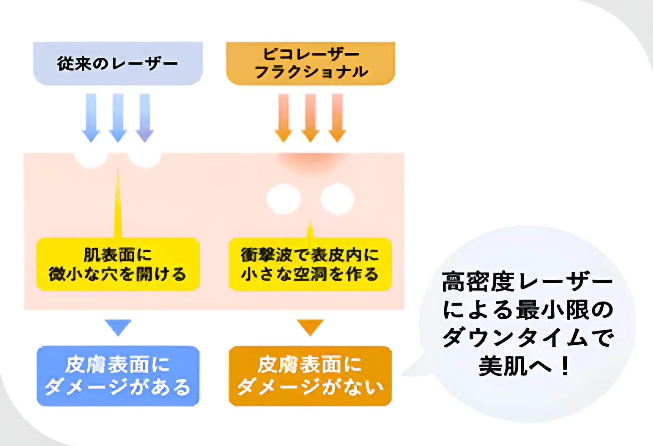 湘南美容クリニックのアクネスカーピコの効果