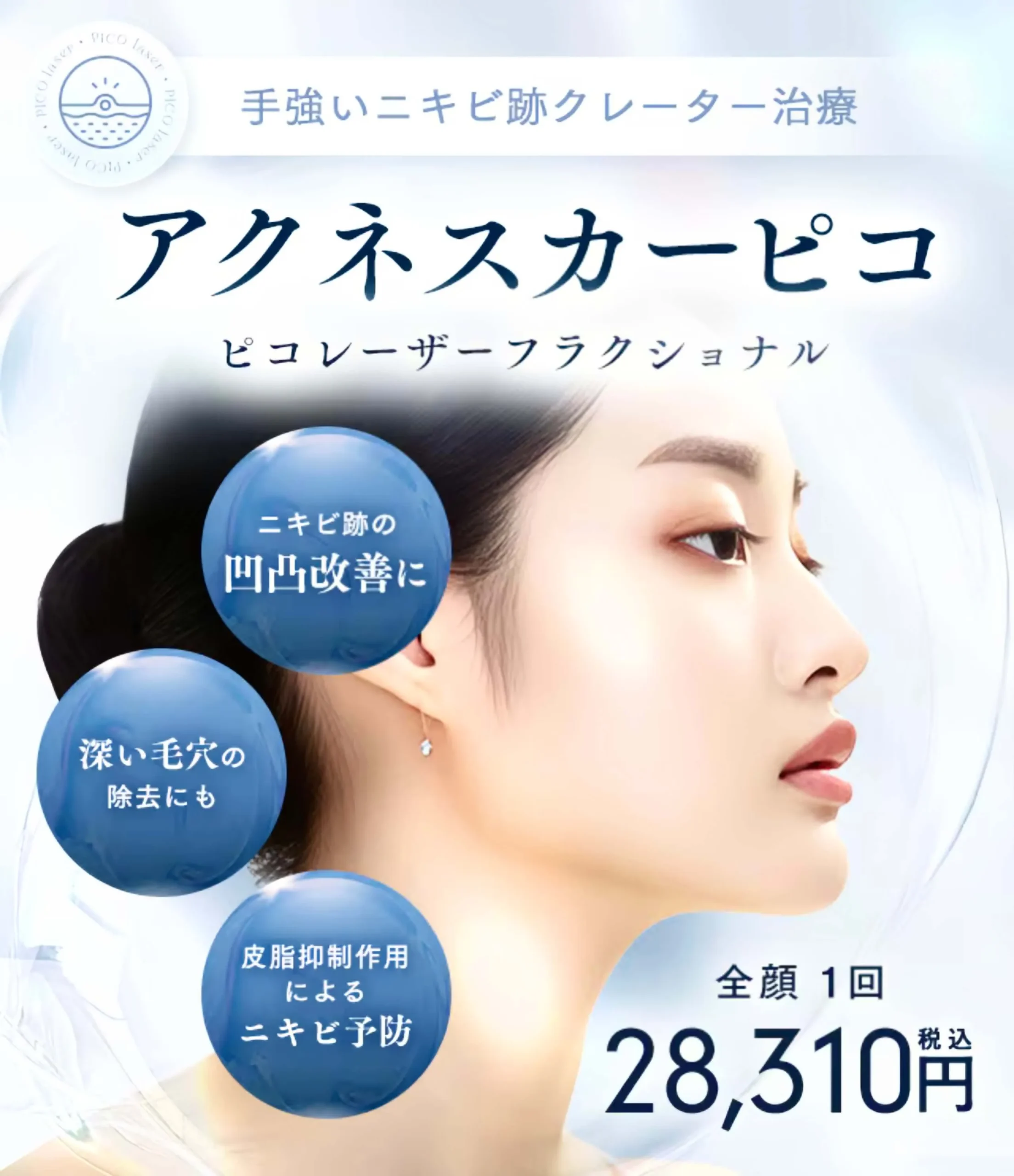 湘南美容クリニックのアクネスカーピコ