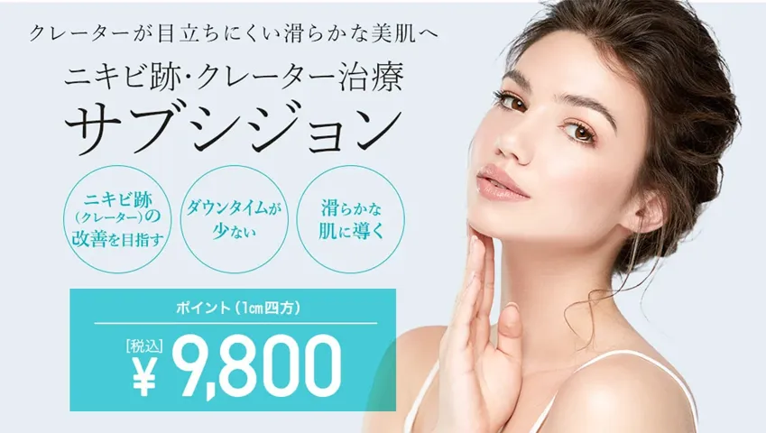 TCBのサブシジョン