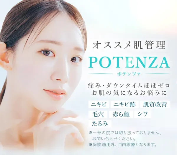 TCBのポテンツァ