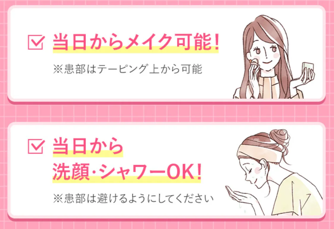 TCB ほくろ・いぼ除去 施術の特徴