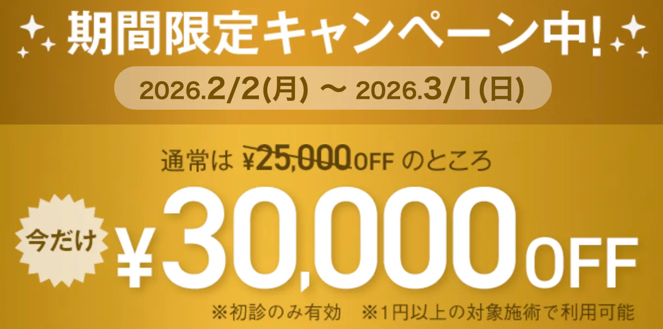 TCB 期間限定30,000円OFFキャンペーン
