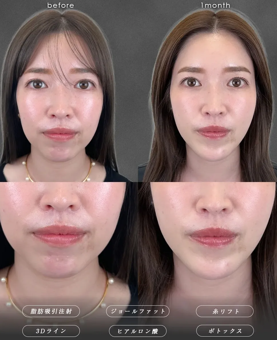 どこの店舗がいい？知恵袋では分からないTCB　富田 秀鷹医師の症例写真