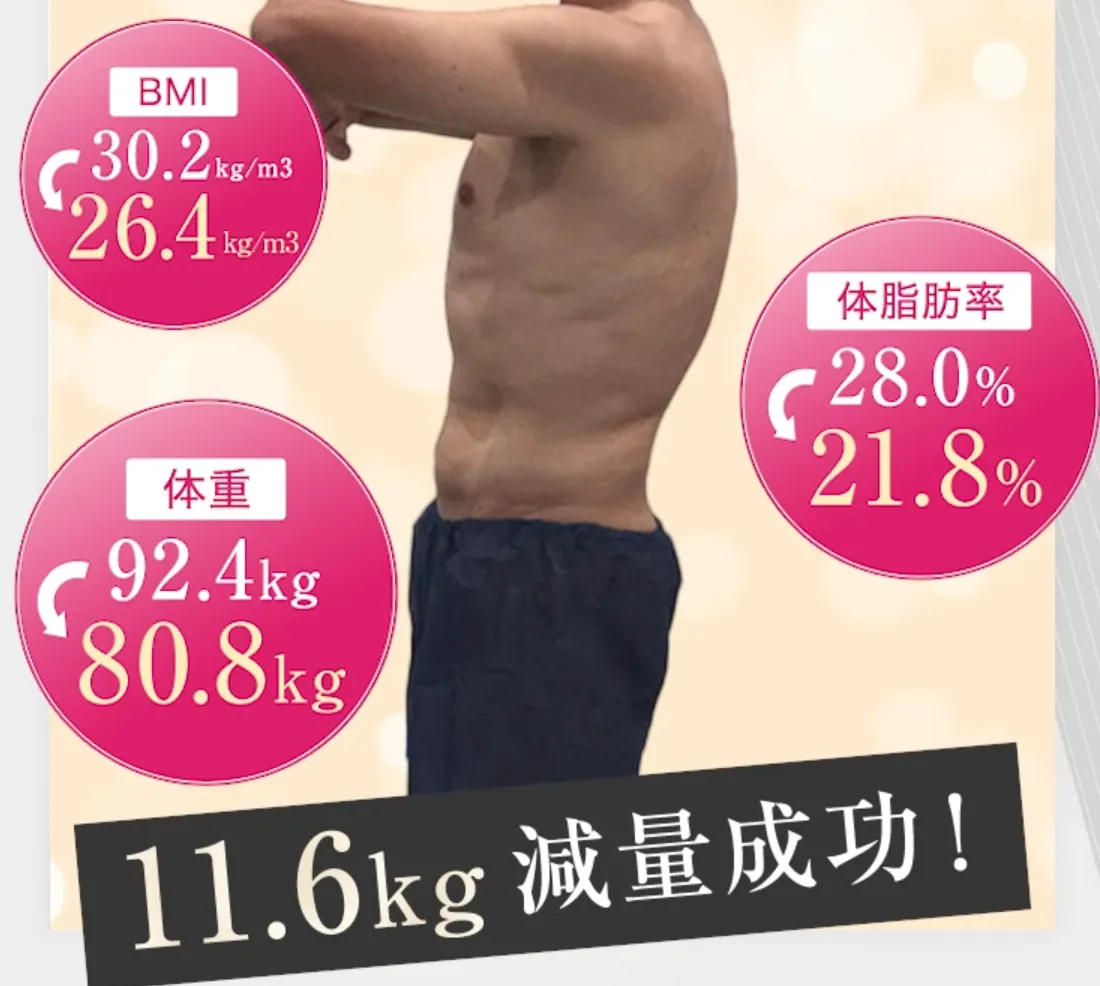 新宿で脂肪冷却が安いおすすめのクリニック【メンズ向けも】｜uraraクリニックの男性症例写真