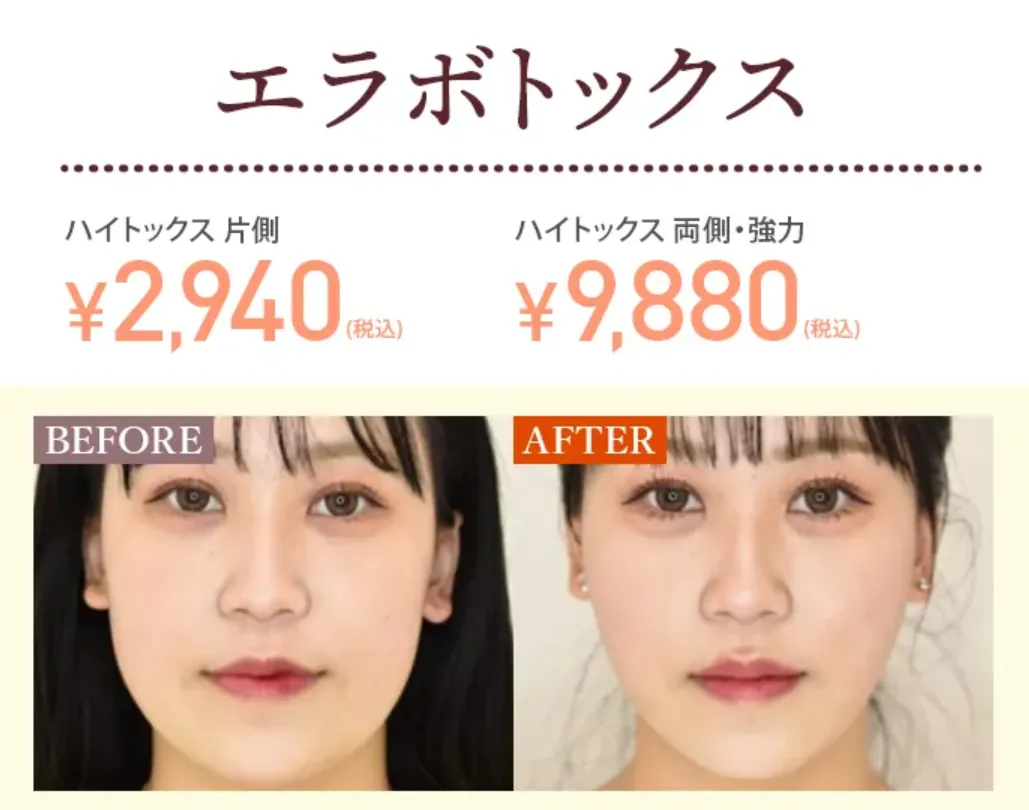 TCBの医療ローンで受けられる人気施術｜ボトックス施術症例