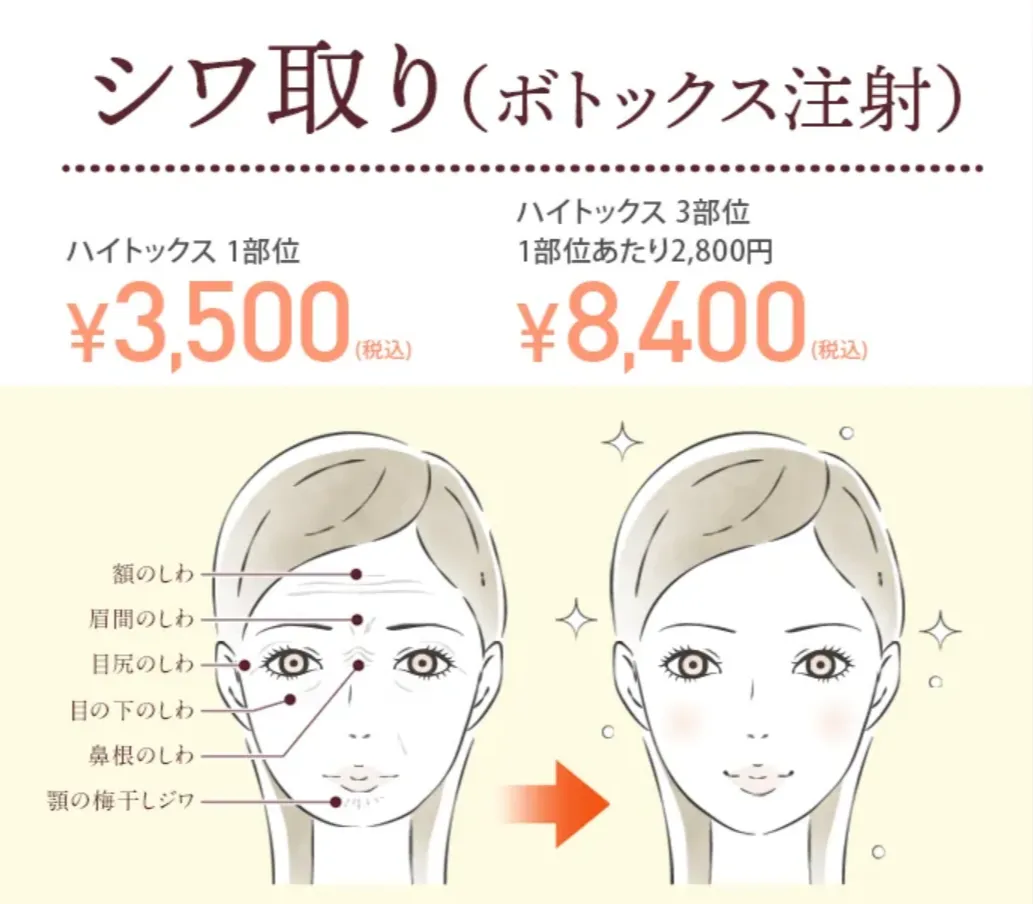 TCBの医療ローンで受けられる人気施術｜ボトックス施術症例