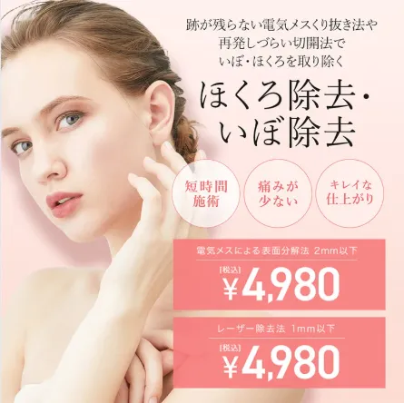 TCBのほくろ除去広告