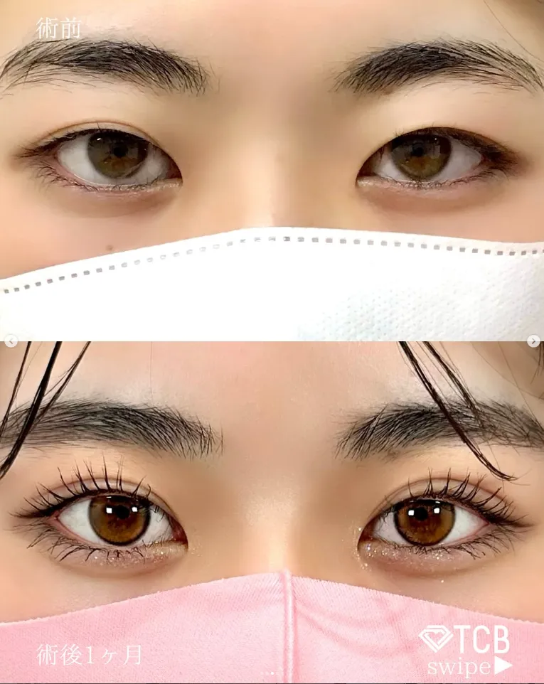 TCB渋谷東口院の施術症例①