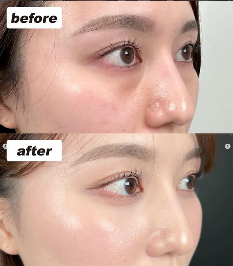 TCB渋谷東口院の施術症例②