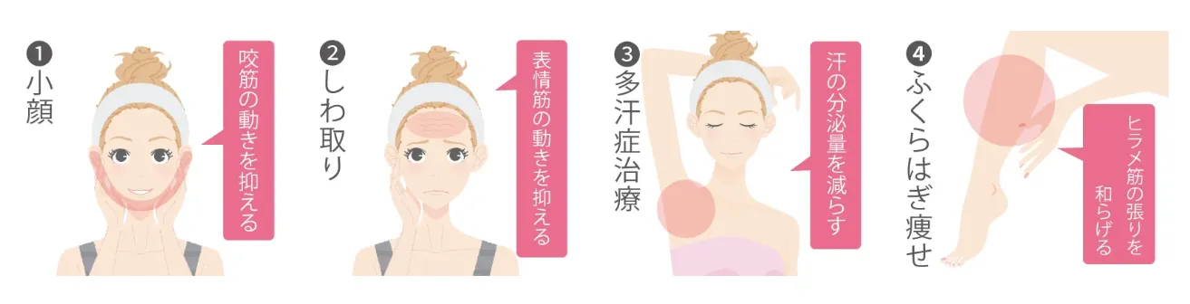 TCBの医療ローンで受けられる人気施術｜ボトックス