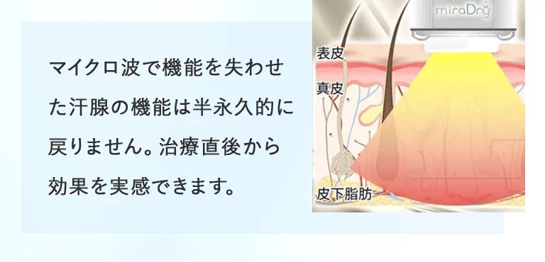 共立美容外科のミラドライの効果