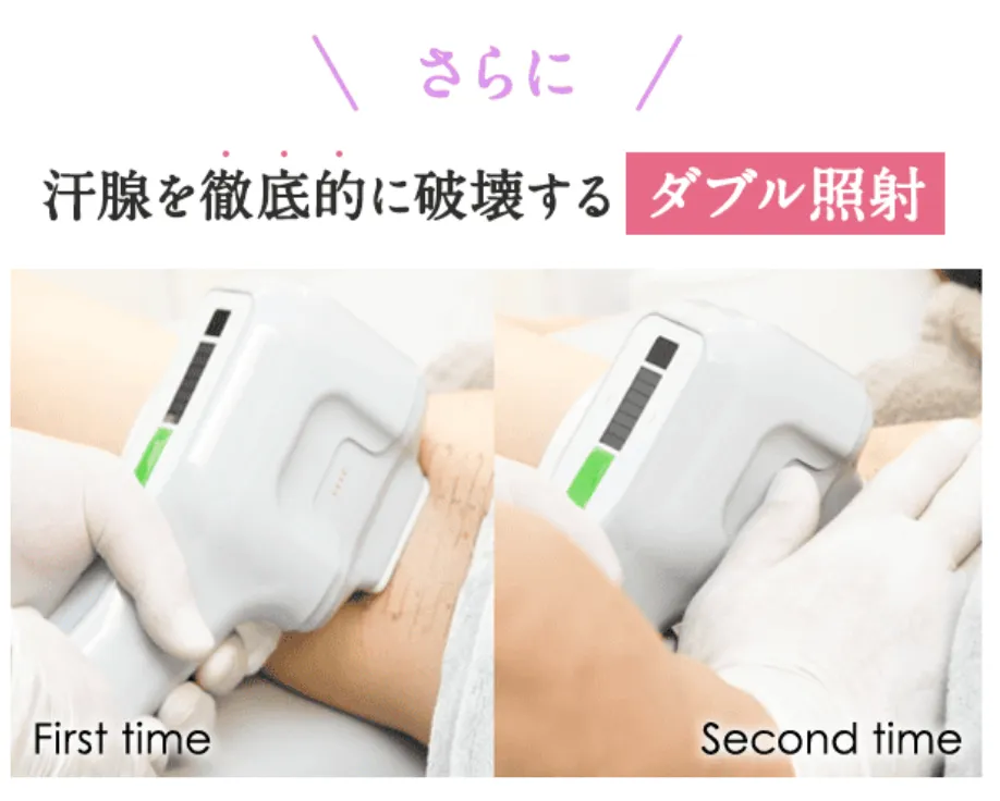 岡山でミラドライが安いおすすめのクリニック 共立美容外科の施術についての症例写真