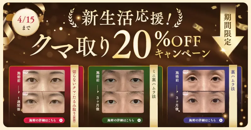 SBC湘南美容クリニックの4月の月替わりキャンペーン　クマ取り料金