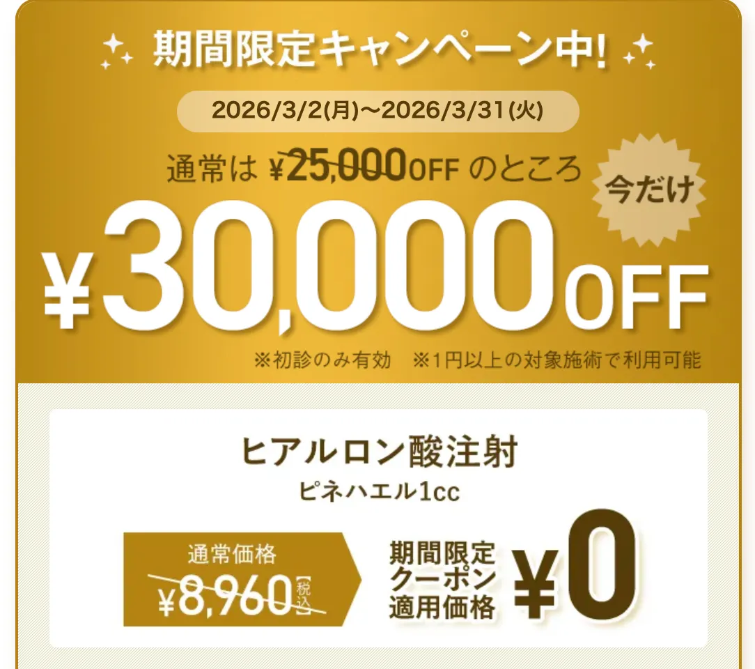 TCB 期間限定30,000円OFFクーポン