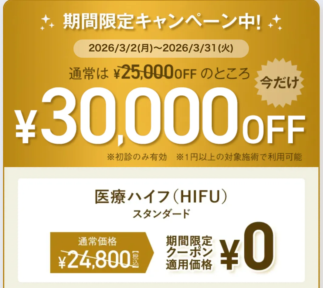 TCB 期間限定 30,000円OFFクーポン