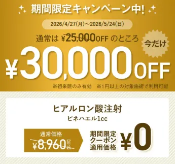 TCB 期間限定30,000円OFFクーポン