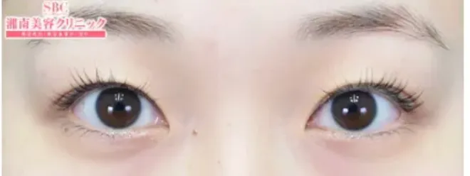 症例③ before