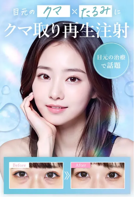 江戸川区でおすすめのクマ取り整形