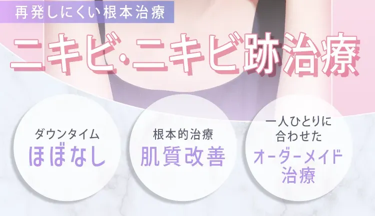 TCBのサブシジョンの特徴