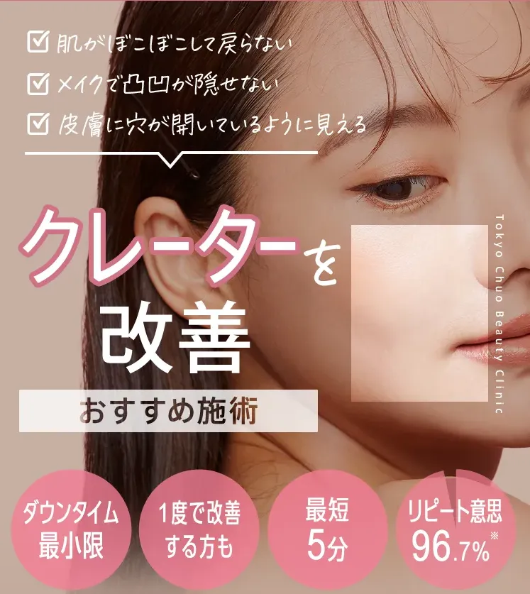 TCBのクレーター改善